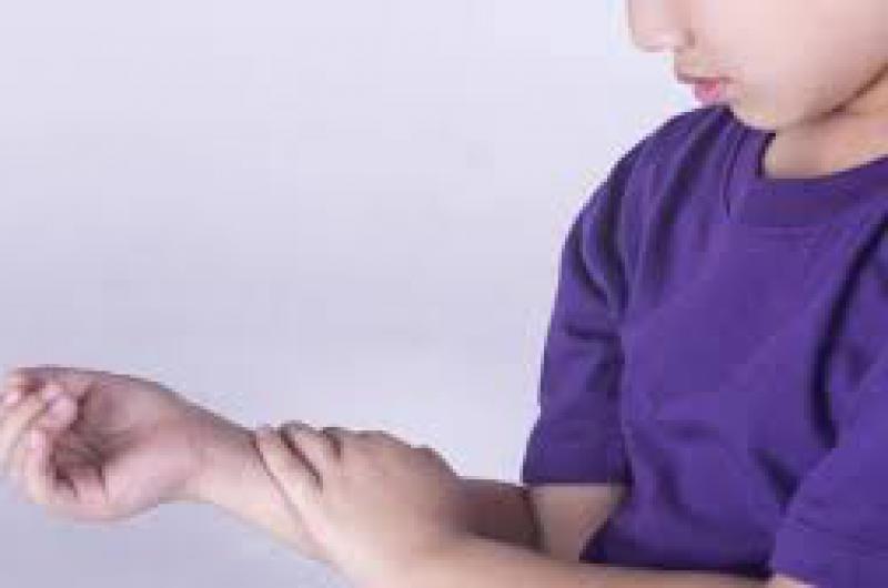 Siacutentomas tratamientos y control de la enfermedad reumaacutetica en la infancia 