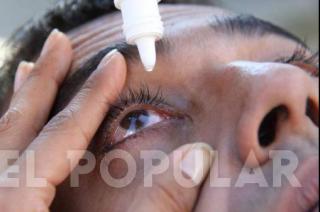 La queratitis es una inflamación de la córnea