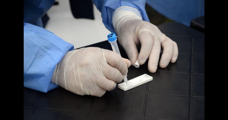 Se clasificar como caso confirmado toda persona que reúna al menos uno de los criterios epidemiológicos y uno de los criterios clínicos establecidos