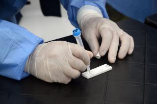 Se clasificar como caso confirmado toda persona que reúna al menos uno de los criterios epidemiológicos y uno de los criterios clínicos establecidos