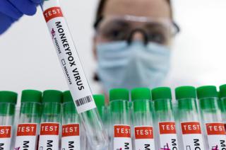 Todavía no hay evidencia científica para avanzar en la adquisición de vacunas contra la viruela del mono -DIB-
